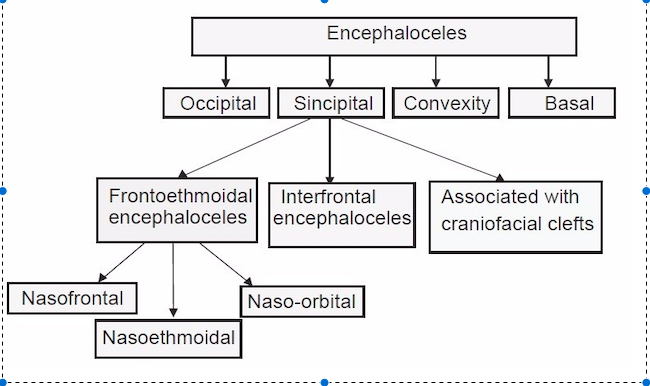 Classification of encephaloceles.png